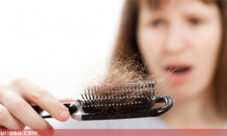 Por qué se nos cae el pelo