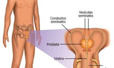 Enfermedades del aparato reproductor masculino