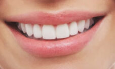 Curiosidades sobre los dientes