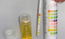 Proteínas en la orina