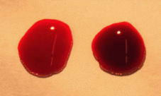 ¿Por qué la sangre es de color rojo?