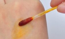 La tintura de yodo en el botiquín